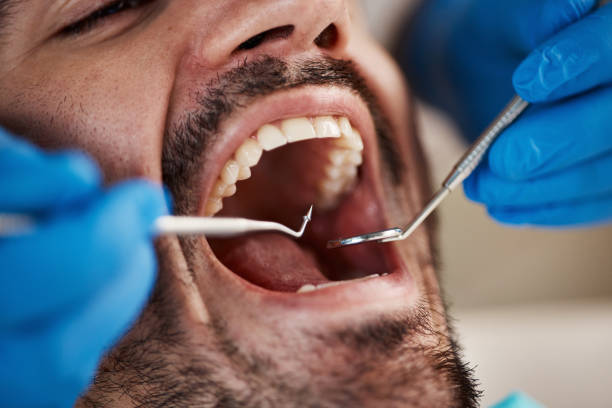 Best Cosmetic Emergency Dentistry in Sachse, TX